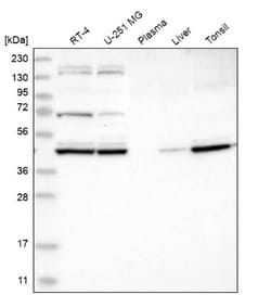 KBTBD2 Antibody, Novus Biologicals 0.1mL; Unlabeled:Antibodies, Polyclonal